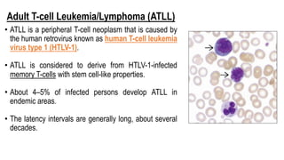 Adult T-cell Leukemia/Lymphoma (ATLL)
• ATLL is a peripheral T-cell neoplasm that is caused by
the human retrovirus known as human T-cell leukemia
virus type 1 (HTLV-1).
• ATLL is considered to derive from HTLV-1-infected
memory T-cells with stem cell-like properties.
• About 4–5% of infected persons develop ATLL in
endemic areas.
• The latency intervals are generally long, about several
decades.
 