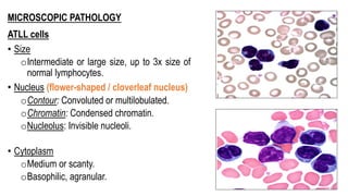 MICROSCOPIC PATHOLOGY
ATLL cells
• Size
oIntermediate or large size, up to 3x size of
normal lymphocytes.
• Nucleus (flower-shaped / cloverleaf nucleus)
oContour: Convoluted or multilobulated.
oChromatin: Condensed chromatin.
oNucleolus: Invisible nucleoli.
• Cytoplasm
oMedium or scanty.
oBasophilic, agranular.
 