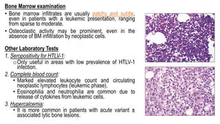 Bone Marrow examination
• Bone marrow infiltrates are usually patchy and subtle,
even in patients with a leukemic presentation, ranging
from sparse to moderate.
• Osteoclastic activity may be prominent, even in the
absence of BM infiltration by neoplastic cells.
Other Laboratory Tests
1. Seropositivity for HTLV-1:
oOnly useful in areas with low prevalence of HTLV-1
infection.
2. Complete blood count:
• Marked elevated leukocyte count and circulating
neoplastic lymphocytes (leukemic phase).
• Eosinophilia and neutrophilia are common due to
release of cytokines from leukemic cells.
3. Hypercalcemia:
• It is more common in patients with acute variant ±
associated lytic bone lesions.
 