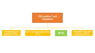CD4 positive T-cell
neoplasms
T-prolymphocytic
leukemia (T-PLL)
Adult T-cell leukemia/lymphoma
(ATLL) MF/SS
Anaplastic large cell
lymphoma (ALCL)
 