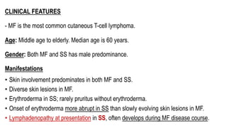 CLINICAL FEATURES
- MF is the most common cutaneous T-cell lymphoma.
Age: Middle age to elderly. Median age is 60 years.
Gender: Both MF and SS has male predominance.
Manifestations
• Skin involvement predominates in both MF and SS.
• Diverse skin lesions in MF.
• Erythroderma in SS; rarely pruritus without erythroderma.
• Onset of erythroderma more abrupt in SS than slowly evolving skin lesions in MF.
• Lymphadenopathy at presentation in SS, often develops during MF disease course.
 