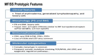 MF/SS Prototypic Features
 