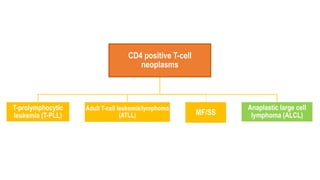 CD4 positive T-cell
neoplasms
T-prolymphocytic
leukemia (T-PLL)
Adult T-cell leukemia/lymphoma
(ATLL) MF/SS
Anaplastic large cell
lymphoma (ALCL)
 