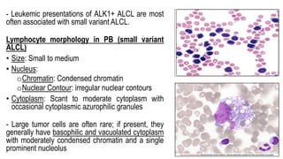 - Leukemic presentations of ALK1+ ALCL are most
often associated with small variant ALCL.
Lymphocyte morphology in PB (small variant
ALCL)
• Size: Small to medium
• Nucleus:
oChromatin: Condensed chromatin
oNuclear Contour: irregular nuclear contours
• Cytoplasm: Scant to moderate cytoplasm with
occasional cytoplasmic azurophilic granules
- Large tumor cells are often rare; if present, they
generally have basophilic and vacuolated cytoplasm
with moderately condensed chromatin and a single
prominent nucleolus
 