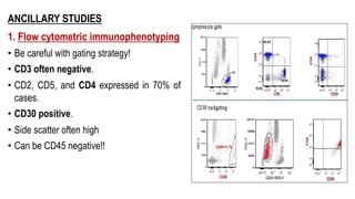 ANCILLARY STUDIES
1. Flow cytometric immunophenotyping
• Be careful with gating strategy!
• CD3 often negative.
• CD2, CD5, and CD4 expressed in 70% of
cases.
• CD30 positive.
• Side scatter often high
• Can be CD45 negative!!
 