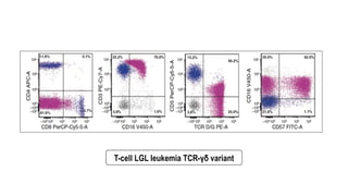 T-cell LGL leukemia TCR-γδ variant
 