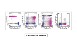 CD4+ T-cell LGL leukemia
 
