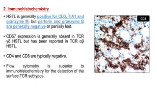 2. Immunohistochemistry
• HSTL is generally positive for CD3, TIA1 and
granzyme M, but perforin and granzyme B
are generally negative or partially lost.
• CD57 expression is generally absent in TCR
γδ HSTL but has been reported in TCR αβ
HSTL.
• CD4 and CD8 are typically negative.
• Flow cytometry is superior to
immunohistochemistry for the detection of the
surface TCR subtypes.
CD3
 