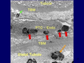 21
Tubule
Distal Tubule
PTC - Endo
TBM
TBM
 