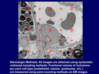 23
Stereologic Methods: All images are obtained using systematic
unbiased sampling methods. Fractional volume of inclusions
per each cell type (endothelial, tubular, podocytes, etc.)
are measured using point counting methods on EM images
 