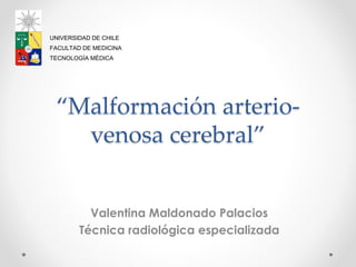 “Malformación arterio-
venosa cerebral”
Valentina Maldonado Palacios
Técnica radiológica especializada
UNIVERSIDAD DE CHILE
FACULTAD DE MEDICINA
TECNOLOGÍA MÉDICA
 