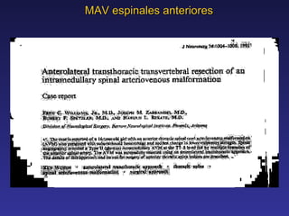MAV espinales anteriores 