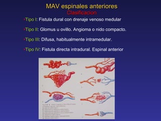 MAV espinales anteriores Clasificacion Tipo I : Fistula dural con drenaje venoso medular   Tipo II : Glomus u ovillo. Angioma o nido compacto. Tipo III : Difusa, habitualmente intramedular. Tipo IV : Fistula directa intradural. Espinal anterior 