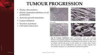 Origin of Cancer | PPTX