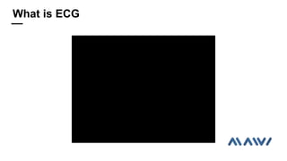 What is ECG
 