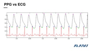 PPG vs ECG
 
