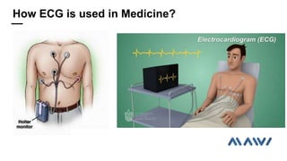 How ECG is used in Medicine?
 