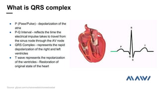  P (Pase/Pulse) - depolarization of the
atria
 P-Q Interval - reflects the time the
electrical impulse takes to travel from
the sinus node through the AV node
 QRS Complex - represents the rapid
depolarization of the right and left
ventricles
 T wave represents the repolarization
of the ventricles - Restoration of
original state of the heart
What is QRS complex
Source: gfycat.com/ru/naiverealistichorseshoebat
 