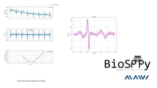 Source:https://biosppy.readthedocs.io/en/stable/
 