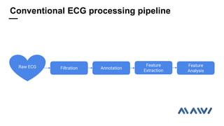 FiltrationRaw ECG Annotation
Feature
Extraction
Feature
Analysis
Conventional ECG processing pipeline
 