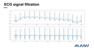 ECG signal filtration
 