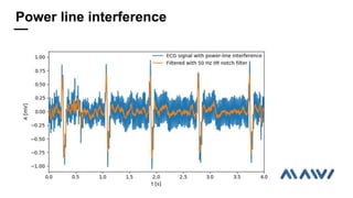 Power line interference
 