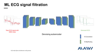 Denoising autoencoder
1D Convolution
1D MaxPooling
Raw ECG signal with
EMG noize
Denoized ECG
Source:https://github.com/softserveinc-rnd/ecg-denoise
ML ECG signal filtration
 