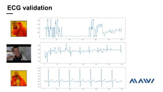 ECG validation
 