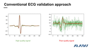 High quality signal Poor quality signal
Conventional ECG validation approach
 