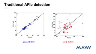 Sinus Rhythm AFib rhythm
Traditional AFib detection
 