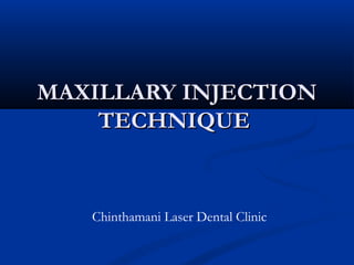 MAXILLARY INJECTION
TECHNIQUE

Chinthamani Laser Dental Clinic

 