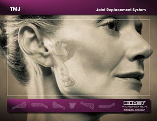 Anticipate. Innovate.TM
TMJ Joint Replacement System
 