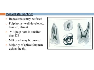 Permanent Maxillary First Molar of Oral Cavity | PPT