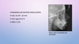 MANDIBULAR INCISOR ANGULATION
md1-nb 34°, 10 mm
md1-apg (mm) 4
IMPA (°) 95
PROCLINED MANDIBULAR
INCISORS
 