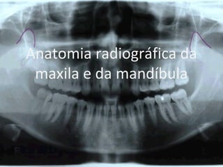 Anatomia radiográfica da
maxila e da mandíbula
 