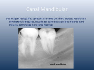 Canal Mandibular
Sua imagem radiográfica apresenta-se como uma linha espessa radiolúcida
com bordos radiopacos, situada por baixo das raízes dos molares e pré-
molares, terminando no forame mentual.
 