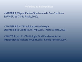  
Referências Bibliográficas
- MADEIRA,Miguel Carlos-“Anatomia da Face”,editora
SARVIER, ed 7-São Paulo,2010;
- WHAITES,Eric-“Princípios de Radiologia
Odontológica”,editora ARTMED,ed 3-Porto Alegre,2003;
- WHITE.Stuart C. -”Radiologia Oral Fundamentos e
interpretação”editora MOSBY.ed 5- Rio de Janeiro,2007.
 