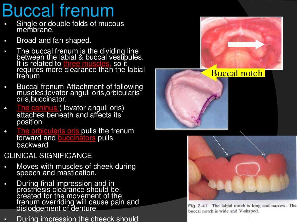 significance of maxillary denture bearing area