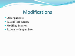 Modifications
 Older patients
 Palatal Tori surgery
 Modified incision
 Patient with open bite
 