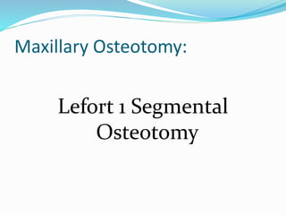 Maxillary Osteotomy:
Lefort 1 Segmental
Osteotomy
 