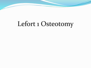 Lefort 1 Osteotomy
 