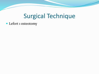 Surgical Technique
 Lefort 1 osteotomy
 
