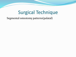 Surgical Technique
Segmental osteotomy patterns(palatal)
 