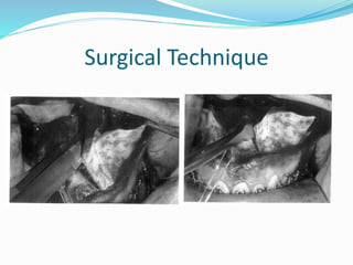 Surgical Technique
 
