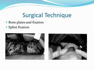 Surgical Technique
 Bone plates and fixation
 Splint fixation
 