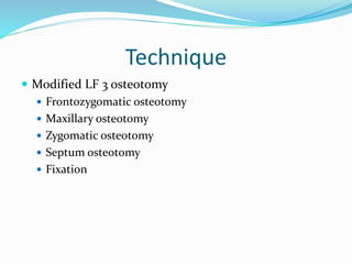 Technique
 Modified LF 3 osteotomy
 Frontozygomatic osteotomy
 Maxillary osteotomy
 Zygomatic osteotomy
 Septum osteotomy
 Fixation
 