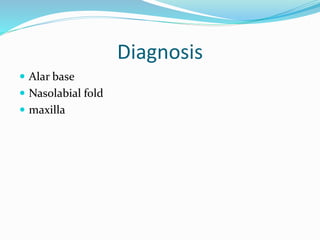 Diagnosis
 Alar base
 Nasolabial fold
 maxilla
 