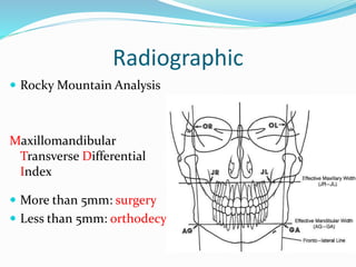 Radiographic
 Rocky Mountain Analysis
Maxillomandibular
Transverse Differential
Index
 More than 5mm: surgery
 Less than 5mm: orthodecy
 