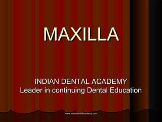 MAXILLAMAXILLA
INDIAN DENTAL ACADEMYINDIAN DENTAL ACADEMY
Leader in continuing Dental EducationLeader in continuing Dental Education
www.indiandentalacademy.comwww.indiandentalacademy.com
 