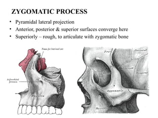 • Pyramidal lateral projection
• Anterior, posterior & superior surfaces converge here
• Superiorly – rough, to articulate with zygomatic bone
ZYGOMATIC PROCESS
 